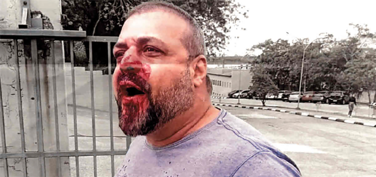 Anderson, sindicalista metalrgico agredido